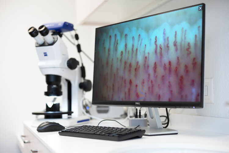 Kapillarmikroskopie mittels Aufsichtsmikroskop (Fa. Carl-Zeiss-Jena) und digitaler Verarbeitung.